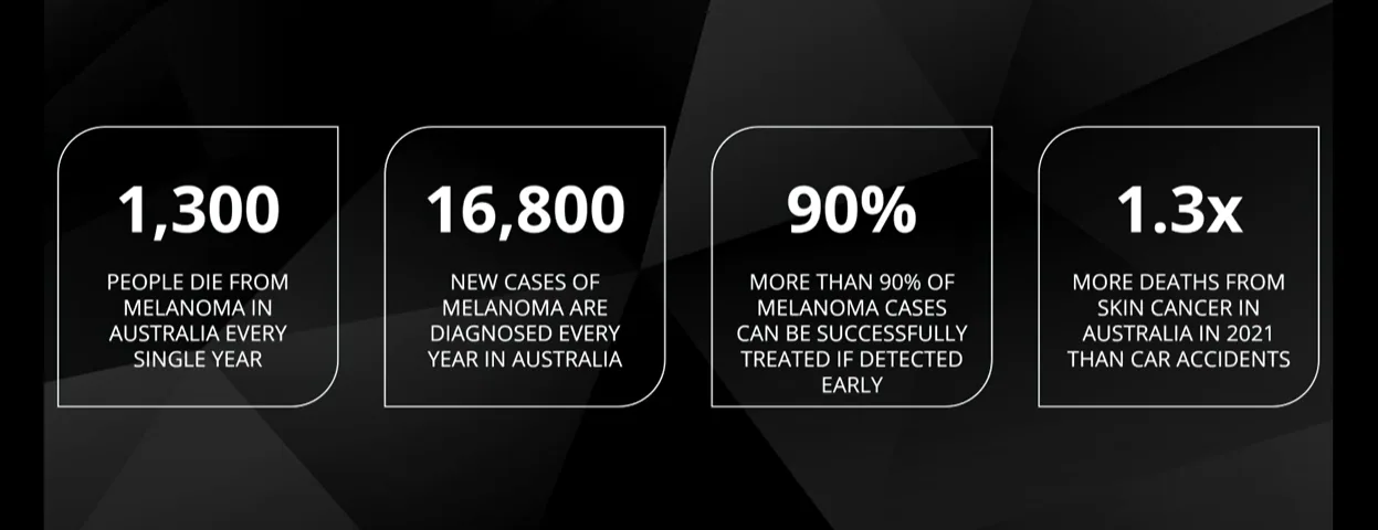 Melanoma stats